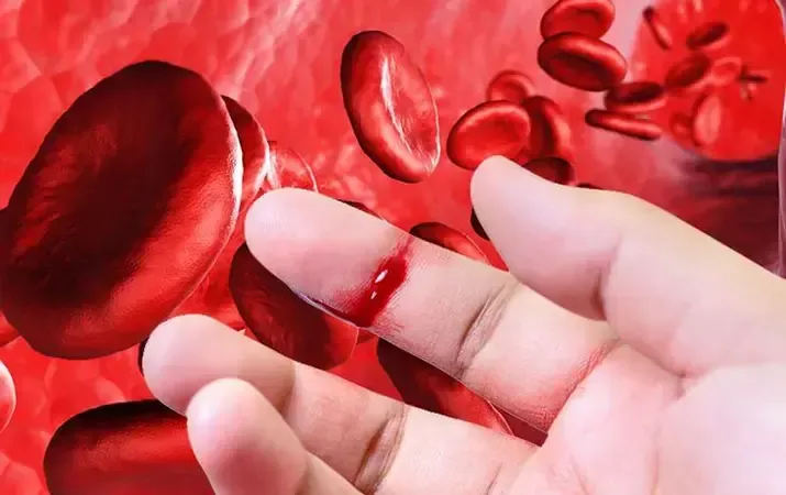 Сколько стоит «бесплатная» помощь пациентам с наследственными коагулопатиями?