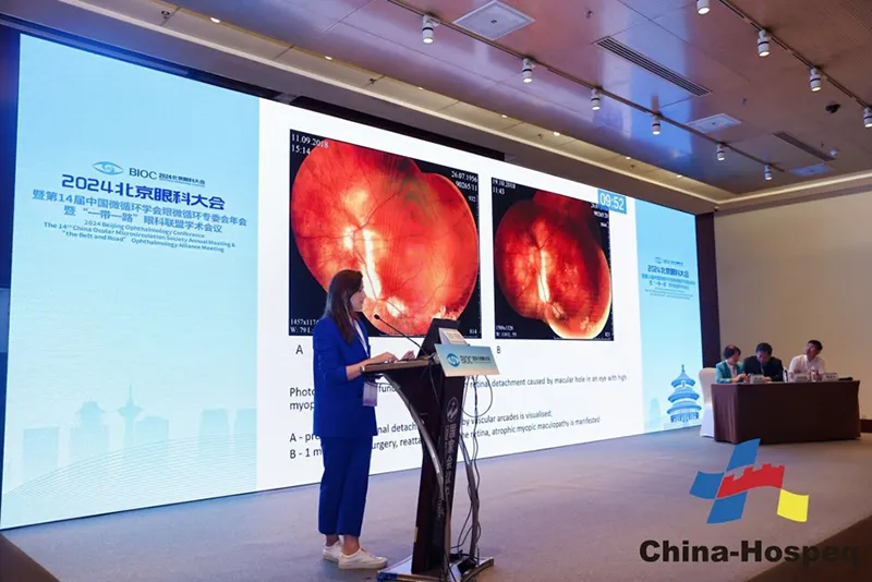 Участие в научной конференции «2024 Пекинский офтальмологический конгресс» (2024 BeijingOphthalmology  Conference)  и в заседании офтальмологического альянса в рамках государственной программы «Один пояс, один путь» «the Belt and  Road» Ophthalmology Alli