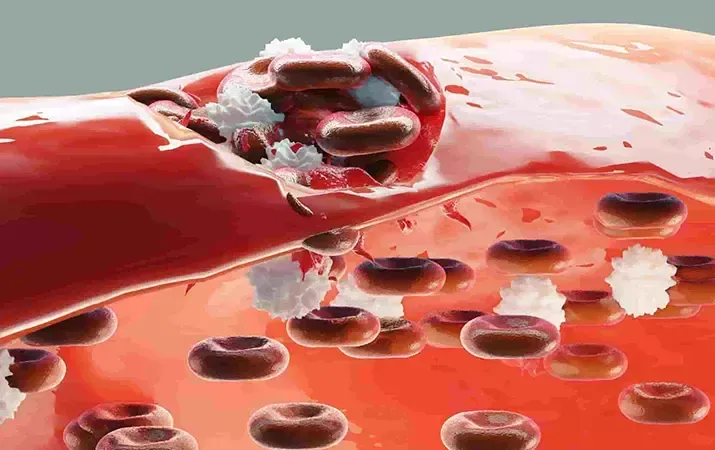 Геморрагический синдром: клиническая оценка и тесты